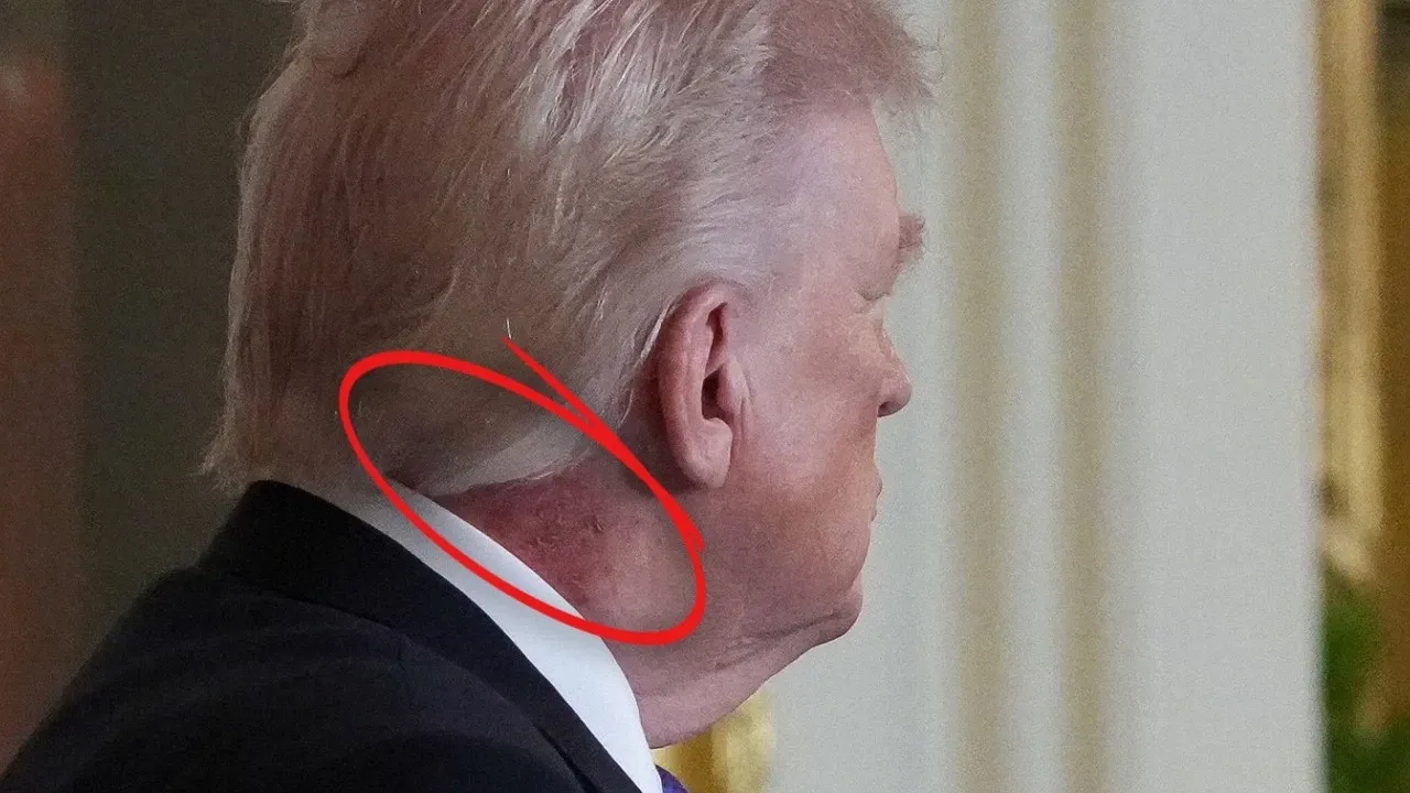 Abdde Gundem Trumpin Kizarikligi Nvgu