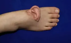 Tıp tarihinde bir ilk yaşandı