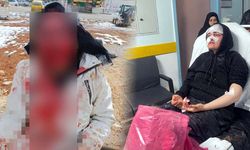 Boşanma aşamasında olduğu kadına kaldırım taşıyla öldüresiye vurdu!