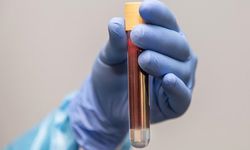 Kanserde aile uyarısı: Risk sanılandan çok daha yüksek