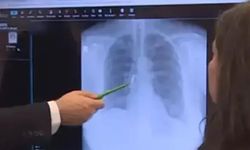 Uyurken akciğerine kaplama dişleri kaçtı!