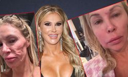 Ünlü yıldız yüzündeki sorunun kaynağına ilişkin konuştu: Çatlamış göğüs implantları