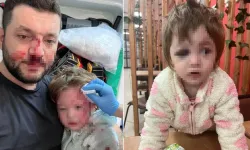 Komşu dehşeti: ‘Gürültü oluyor’ deyip babaya ve 14 aylık bebeğe sopayla saldırdı