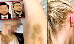 Ünlülerin avukatını darbeden avukatlar hakkında karar