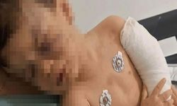 2 yaşındaki çocuğu sopayla darbeden anne ve sevgilisinin cezası belli oldu