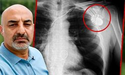 İBB tutuklusu Davut Bildik'in kalp pili kaydı! Hayati tehlikesi var