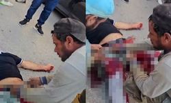 İş insanına tüfekli saldırı! 'Bu sana ders olsun' diyerek vurdu