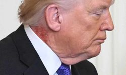 ABD Trump'ın boynundaki kızarıklığı konuşuyor