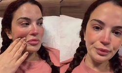 Ameliyatta korkunç hata, 2 kez ölümden döndü: Aslı Bekiroğlu yaşadığı kabusu gözyaşlarıyla anlattı!