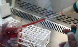 Kalp krizi alarmı: En riskli kan grubu belli oldu!