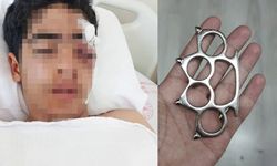 Esenyurt’ta akran dehşeti! 15 yaşındaki çocuk muştayla darbedildi