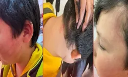 Kabus bitmedi: 8 yaşındaki çocuk sınıf ortasında darp edildi!