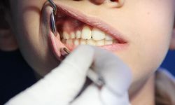 Türkiye’de ağız ve diş sağlığında alarm: Sistem yetersiz kalıyor
