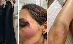 Binlerce kadın aynı sorunu yaşadığını söyledi: Katil pantolon için uyarı yağdı