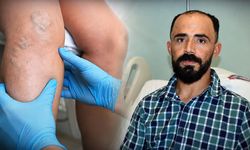 Kahramanmaraş'ta dünyada sadece birkaç tane görülen vaka: Sedef hastalığı nedeniyle atardamarı yırtıldı!