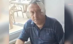 Aşı takibi yapan sağlık çalışanına yumruklu saldırı! Elmacık kemiği üç yerden kırıldı