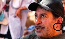 Cem Yılmaz’ın kalp krizi sonrası kulak memesindeki detay gündem oldu