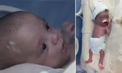 500 gram dünyaya geldi, 5 ay sonra hayata tutundu: Doruk bebek taburcu edildi
