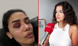 Uzaklaştırma kararına rağmen evinin önünde darbedilen genç kadın: 'Ölmeden önce sesimi duyun'