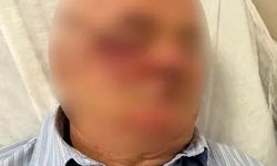 Kartal’da site içinde dehşet: Çocuğu uyaran emekli başkomiser darbedildi