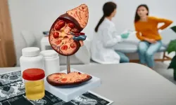 Böbrek kanseri sinsice ilerliyor: En çok dikkat edilmesi gereken 3 belirti