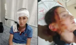 Köpek saldırısında yüzünde kalıcı iz kaldı: 11 yaşındaki çocuk için 1,2 milyon TL’lik tazminat