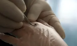 Tokat’ta kene alarmı! Çocuk KKKA şüphesiyle hastaneye kaldırıldı