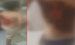 Arnavutköy’de 12 yaşındaki çocuğu kolonya dökerek ateşe verdiler!