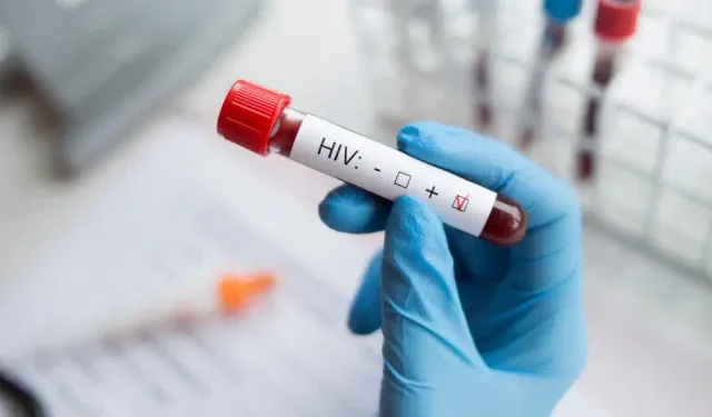 AIDS'e karşı tedavi umudu: HIV virüsünü yüzde 98 etkisiz kılan antikor keşfedildi