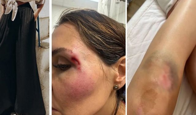 Binlerce kadın aynı sorunu yaşadığını söyledi: Katil pantolon için uyarı yağdı