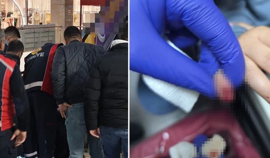 AVM'de yürüyen merdivene eli sıkışan 3 yaşındaki çocuğun parmağı koptu!