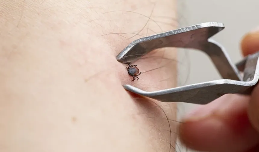 Kene 15 dakikada bulaştırabiliyor: Nadir virüs alarmı büyüyor